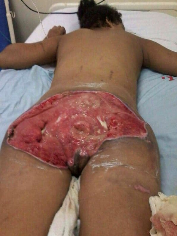 Traição? Homem arranca “bunda” da esposa com um facão