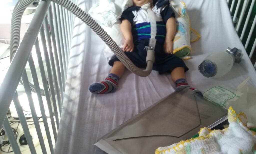 Morreu a criança que nasceu com cordão umbilical no pescoço