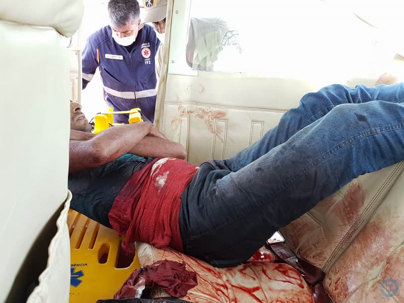 Hoje: Em Coxim homem é esfaqueado e vísceras ficam expostas