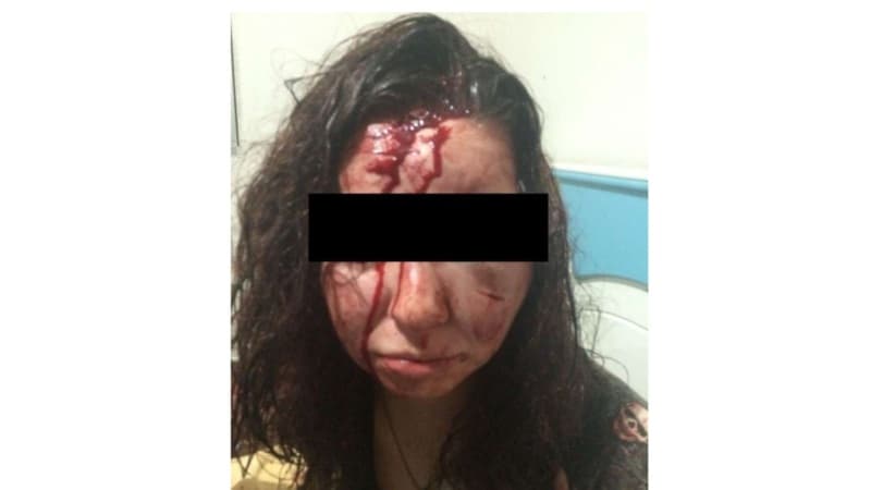 Professora de Santa Fé pega carona, sofre tentativa de estupro e é espancada em Jales-SP
