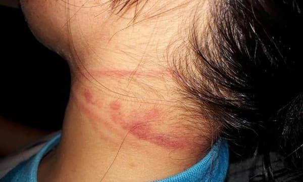 Agora: Homem estupra mulher e ainda desfere 13 facadas na vítima