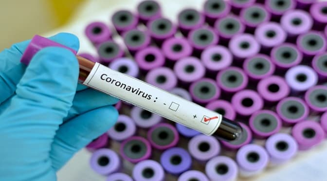 Foram em aniversário no município vizinho: Costa Rica monitora 7 pessoas suspeitas da Covid-19