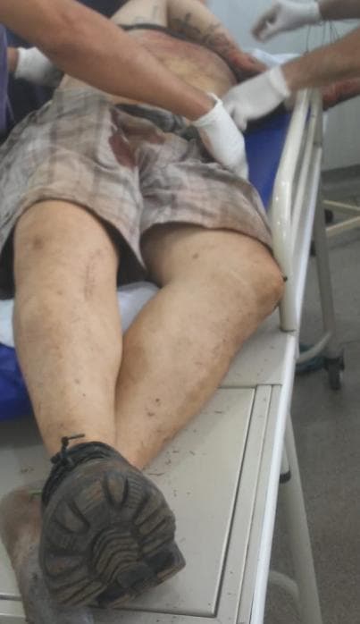 Dois bandidos foram mortos ontem na MS 306 pela Policia Militar de Costa Rica e Chapadão do Sul